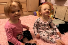 Les sœurs siamoises reliées par la tête sont remises de leur séparation 