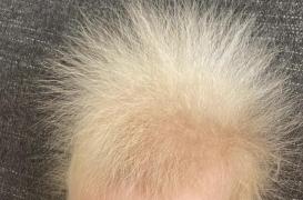 Cet adorable petit garçon souffre du 