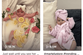 Leur fille est née avec un sourire permanent dû à une malformation rare