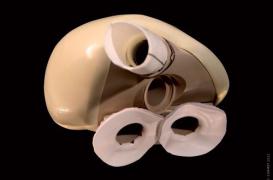 Carmat : le dernier patient greffé est décédé