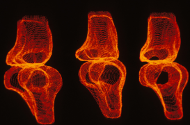 Un implant vivant et en 3D pour régénérer le cartilage