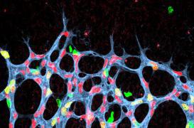 DMLA, rétinopathies : une nouvelles protéine pour traiter la cécité