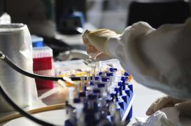 Septicémie : des cellules souches pour éviter les séquelles musculaires