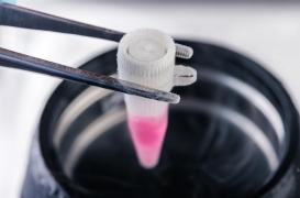 Parkinson : une thérapie cellulaire suscite l'espoir 