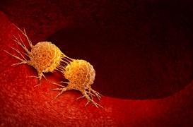 Cancer : l'étude qui perce les secrets des tumeurs