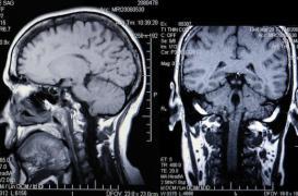 Le cerveau est moins compact que ce que l'on pensait