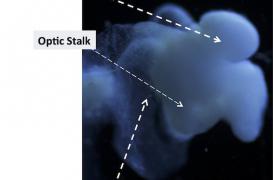 Un mini-cerveau humain produit à partir de cellules de la peau