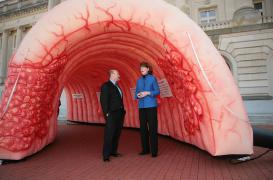 Cancer colorectal : les moins de 50 ans de plus en plus exposés