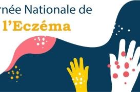 Eczéma chronique des mains : une maladie qui impacte la qualité de vie