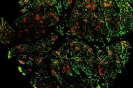 Myopathie de Duchenne : un vieil antidiabétique oral favorise la protection des muscles