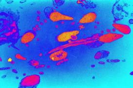 Fumer du cannabis nuit à la qualité du sperme