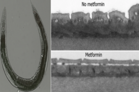 Un antidiabétique retarde le vieillissement des cellules