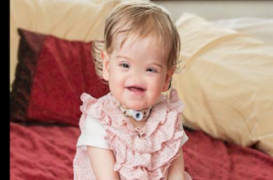 Tessa va se faire implanter un nez artificiel