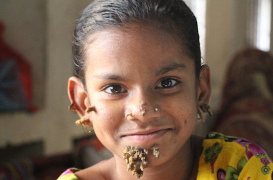 Bangladesh : Sahana serait le premier cas de 