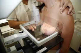 Cancer du sein : les femmes blanches sont plus à risque