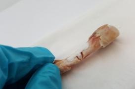 Des chercheurs mettent au point une colle expérimentale capable de réparer les fractures en 5 minutes