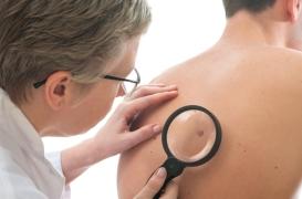  Mélanome : peut-on le détecter grâce à une prise de sang ? 