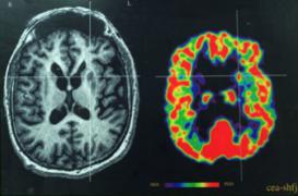 Des chercheurs réussissent à contrôler l’activité des cellules du cerveau