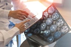 Sclérose en plaques : des cellules immunitaires responsables de l’inflammation ? 