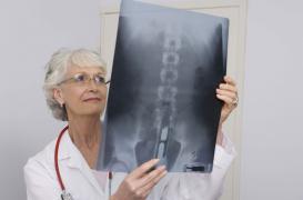 Des cellules souches pour réparer des disques intervertébraux