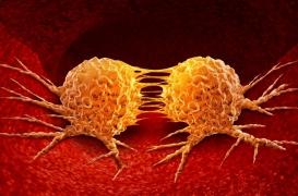 Métastases : comment les cellules cancéreuses deviennent agressives ?