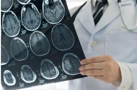 Comment les ordinateurs aident les victimes d’AVC à retrouver la parole 