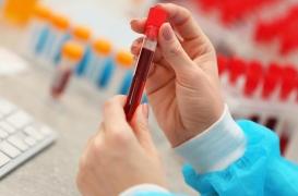 Cancer de la prostate : 