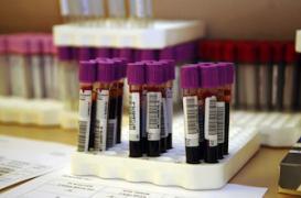 De nombreux dosages en vitamine D sont jugés inutiles