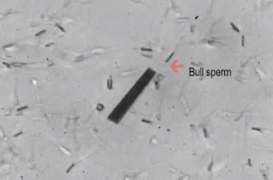 Des robots spermatozoïdes à l'assaut de  l'infertilité