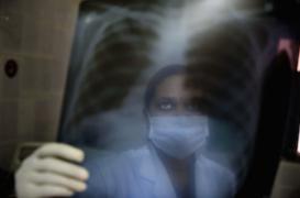 La lutte contre la tuberculose marque des points   