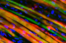 Des chercheurs ont fabriqué un muscle artificiel capable de se contracter