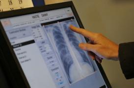 BPCO : le généraliste passe à côté du diagnostic