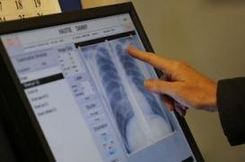 La bronchite chronique du fumeur, un mal insidieux