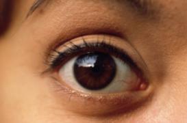 Des cornées cultivées en laboratoire greffées pour la 1ère fois