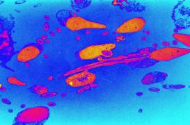 Le déclin significatif du sperme des Français