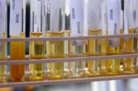 Cancer de la vessie : un test urinaire prometteur