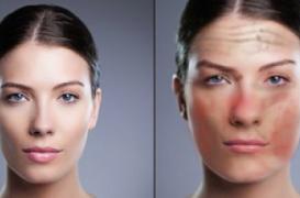 Alcool: une campagne pour montrer les ravages physiques