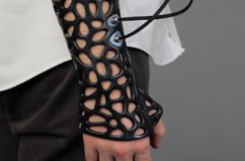 L’imprimante 3D révolutionne la médecine