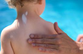 Coup de soleil : le double danger   