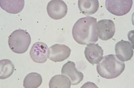 Un aimant pour détecter le paludisme 