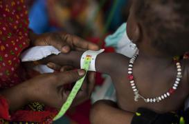 Malnutrition infantile : MSF remet en cause le recours systématique aux antibiotiques 