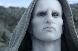 Il attrape un ver parasite de 1,70 mètre après avoir mangé des sushis