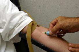 Marqueurs tumoraux : la lutte contre le cancer à l'aube d'une révolution