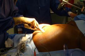 Obésité : la chirurgie bariatrique en plein boom