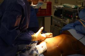 La chirurgie de l'obésité traite le diabète avant le poids