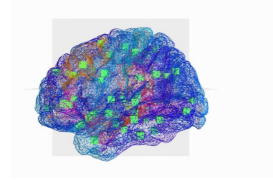 Epilepsie :  mieux traiter la maladie grâce à un cerveau 