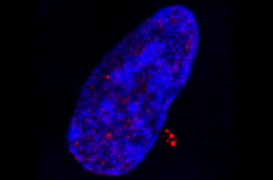 Cancers : le rôle du virus Epstein-Barr mieux compris