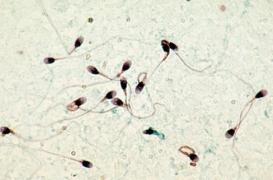 La vasectomie est la méthode de contraception la plus efficace.