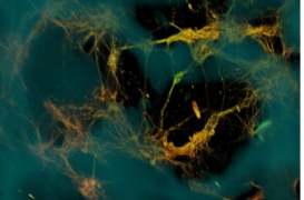 Des chercheurs ont créé un tissu cérébral vivant en 3D