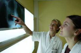 Cancer du poumon : l’arrêt du tabac conduit à des diagnostics tardifs